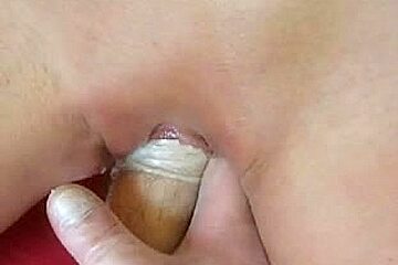Fist fucking a older bald twat
