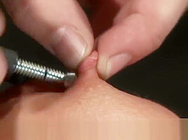 It Stings, It Hurts