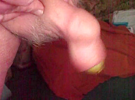 Mr  Potato foreskin - 2