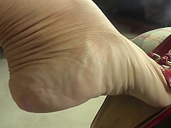My High Arches