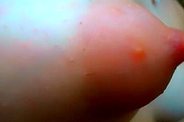 puffy hairy niples