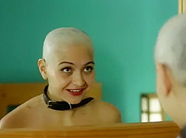 susan bald head